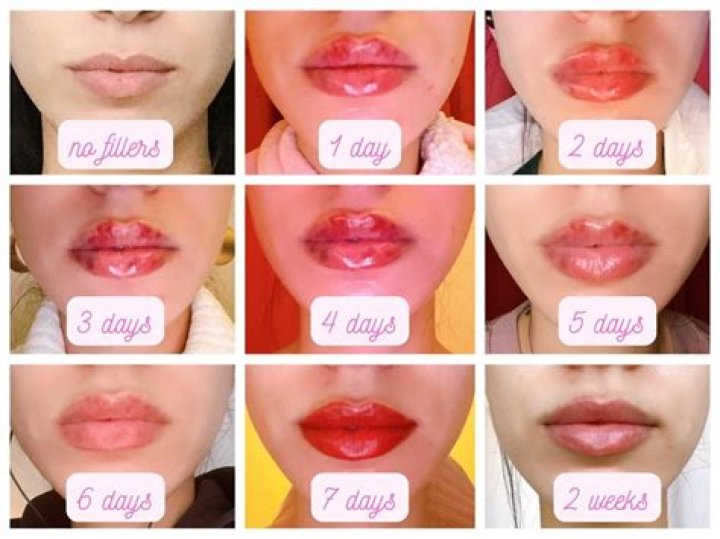 Unveiling The Secrets Of Alanna Panday's Lip Filler: Discoveries And Insights